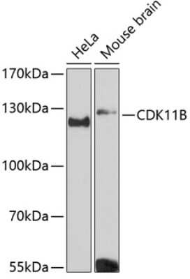 Western Blot: CDC2L1 AntibodyAzide and BSA Free [NBP2-92609]