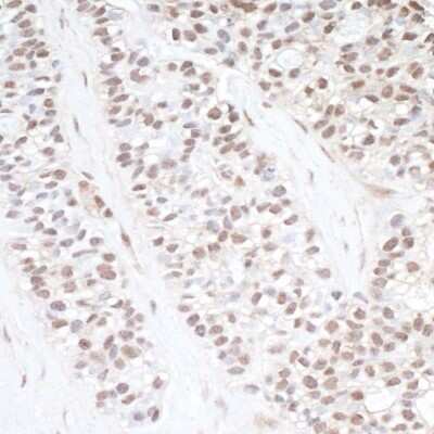 Immunohistochemistry-Paraffin: CDC2L2 Antibody [NB100-496]