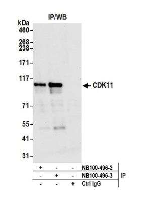 Immunoprecipitation: CDC2L2 Antibody [NB100-496]