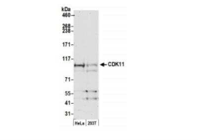 Western Blot: CDC2L2 Antibody [NB100-496]