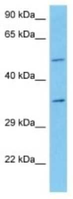 Western Blot: CDC2L2 Antibody [NBP3-10838]