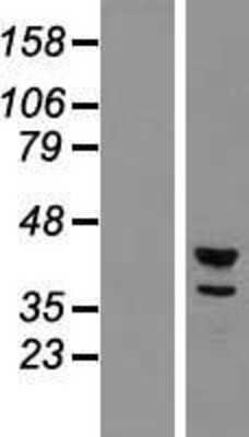 Western Blot: CDC2L2 Overexpression Lysate [NBL1-08999]