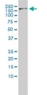 Western Blot: CDC2L5 Antibody (1B3-1B11) [H00008621-M01]
