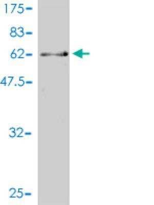 Western Blot: CDC2L5 Antibody (1B3-1B11) [H00008621-M01]