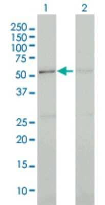 Western Blot: CDC2L5 Antibody (3G1) [H00008621-M02]