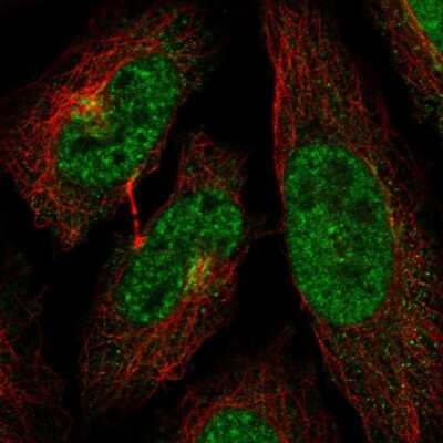 Immunocytochemistry/ Immunofluorescence: CDC2L5 Antibody [NBP2-34123]