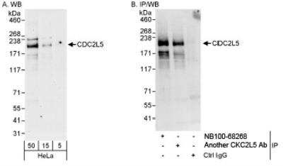 Western Blot: CDC2L5 Antibody [NB100-68268]