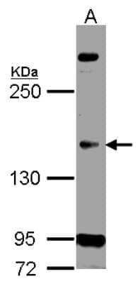 Western Blot: CDC2L5 Antibody [NBP1-33004]