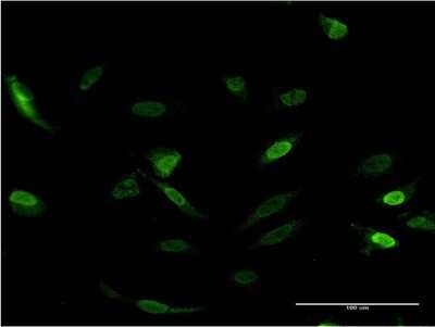 Immunocytochemistry/ Immunofluorescence: CDC2L6 Antibody (8B6) [H00023097-M06]