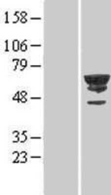 Western Blot: CDC2L6 Overexpression Lysate [NBL1-09000]