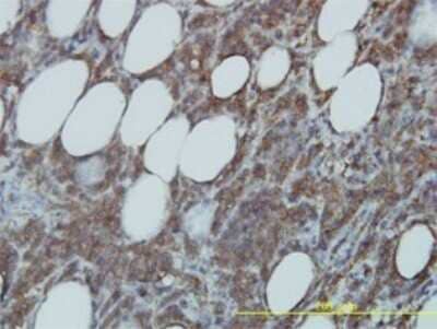 Immunohistochemistry-Paraffin: CDC37 Antibody (3C7) [H00011140-M01]