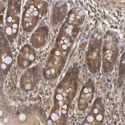 Immunohistochemistry-Paraffin: CDC37 Antibody [NBP1-80960]