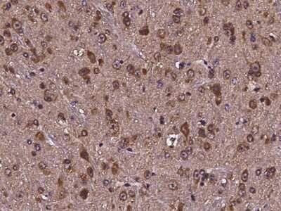 Immunohistochemistry-Paraffin: CDC37 Antibody [NBP2-98122]