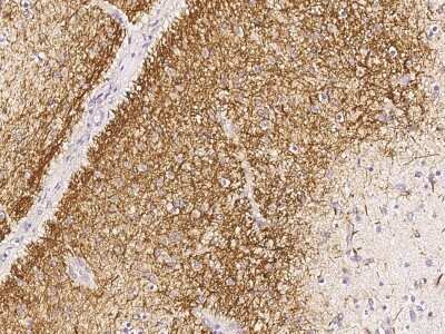 Immunohistochemistry-Paraffin: CDC37 Antibody [NBP2-98986]