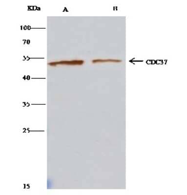Immunoprecipitation: CDC37 Antibody [NBP2-99422]