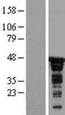 Western Blot: CDC37 Overexpression Lysate [NBL1-09002]