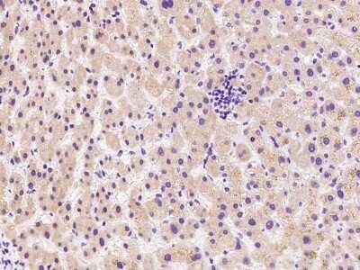 Immunohistochemistry: CDC37L1 Antibody [NBP2-98987]