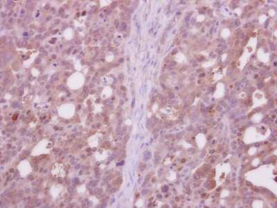 Immunohistochemistry-Paraffin: CDC37L1 Antibody [NBP2-15831]