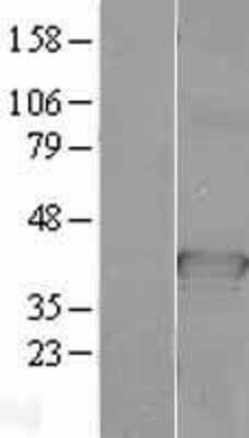 Western Blot: CDC37L1 Overexpression Lysate [NBL1-09003]