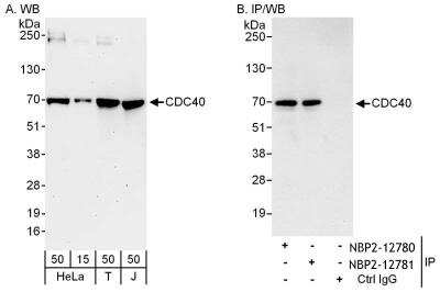 Immunoprecipitation: CDC40 Antibody [NBP2-12780]