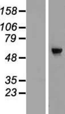 Western Blot: CDC40 Overexpression Lysate [NBP2-07106]