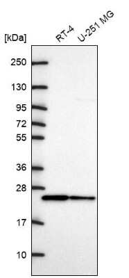 Western Blot: CDC42 Antibody [NBP2-68888]