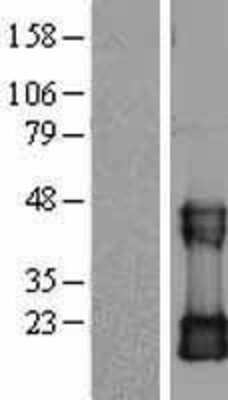 Western Blot: CDC42 Overexpression Lysate [NBL1-09004]