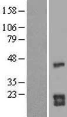 Western Blot: CDC42 Overexpression Lysate [NBL1-09005]