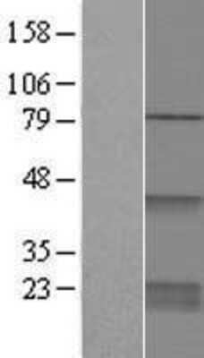 Western Blot: CDC42 Overexpression Lysate [NBP2-05863]