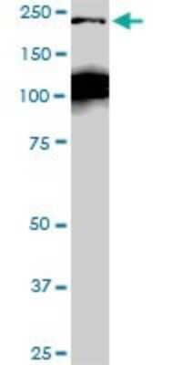 Western Blot: CDC42BPB Antibody (2D8) [H00009578-M04]