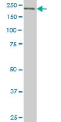 Western Blot: CDC42BPB Antibody (2F4) [H00009578-M03]