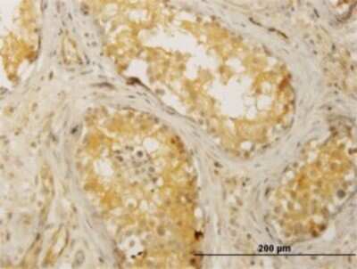 Immunohistochemistry-Paraffin: CDC42BPB Antibody (6G3) [H00009578-M02]