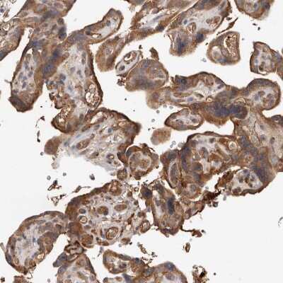 Immunohistochemistry-Paraffin: CDC42BPB Antibody [NBP1-81440]