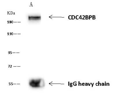 Immunoprecipitation: CDC42BPB Antibody [NBP2-98656]