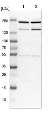 Western Blot: CDC42BPB Antibody [NBP1-81440]