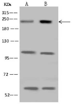 Western Blot: CDC42BPB Antibody [NBP2-98656]