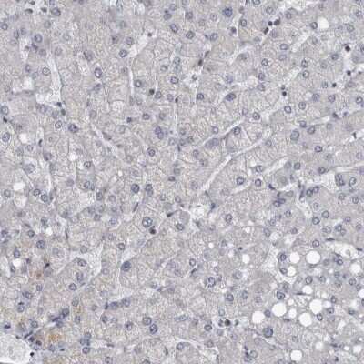 Immunohistochemistry-Paraffin: CDC42BPG Antibody [NBP1-84072]