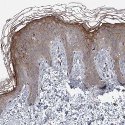 Immunohistochemistry-Paraffin: CDC42BPG Antibody [NBP1-84072]