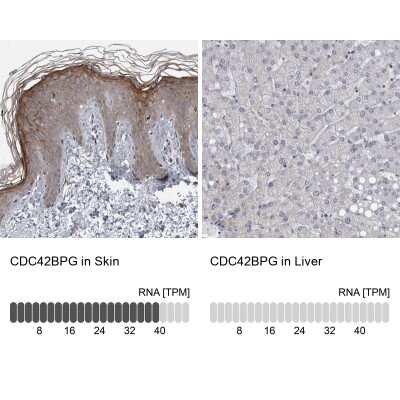 Immunohistochemistry-Paraffin: CDC42BPG Antibody [NBP1-84072]
