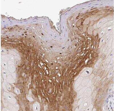 Immunohistochemistry-Paraffin: CDC42BPG Antibody [NBP2-38938]
