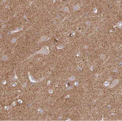 Immunohistochemistry-Paraffin: CDC42BPG Antibody [NBP2-38938]