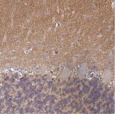 Immunohistochemistry-Paraffin: CDC42BPG Antibody [NBP2-38938]