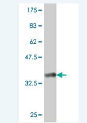 Western Blot: CDC42BPG Antibody [H00055561-A01]