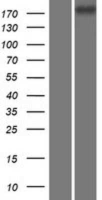 Western Blot: CDC42BPG Overexpression Lysate [NBP2-06969]