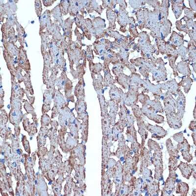 Immunohistochemistry-Paraffin: CDC42EP1 Antibody (4P7S6) [NBP3-15881]