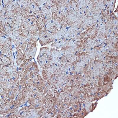 Immunohistochemistry-Paraffin: CDC42EP1 Antibody (4P7S6) [NBP3-15881]