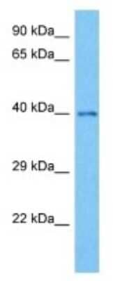 Western Blot: CDC42EP1 Antibody [NBP3-10826]