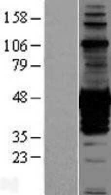 Western Blot: CDC42EP1 Overexpression Lysate [NBP2-07537]