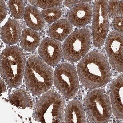 Immunohistochemistry-Paraffin: CDC42EP2 Antibody [NBP1-88383]