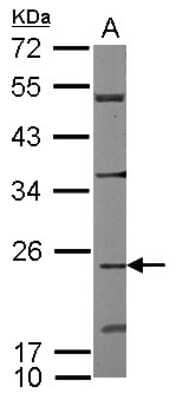 Western Blot: CDC42EP2 Antibody [NBP2-15833]